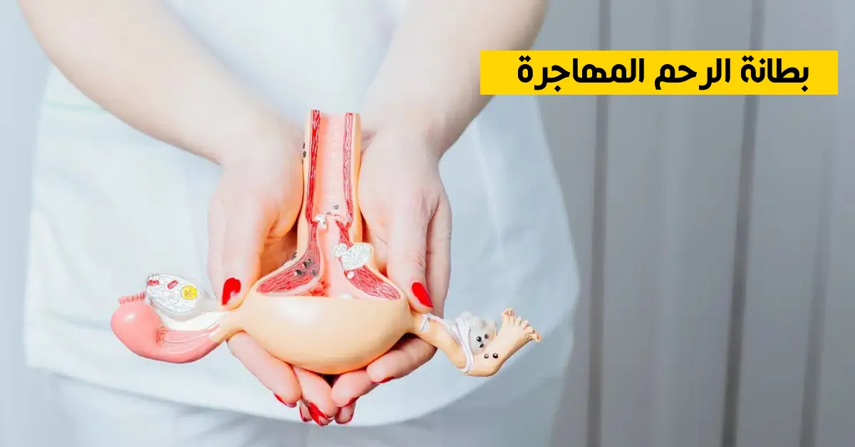 بطانة الرحم المهاجرة